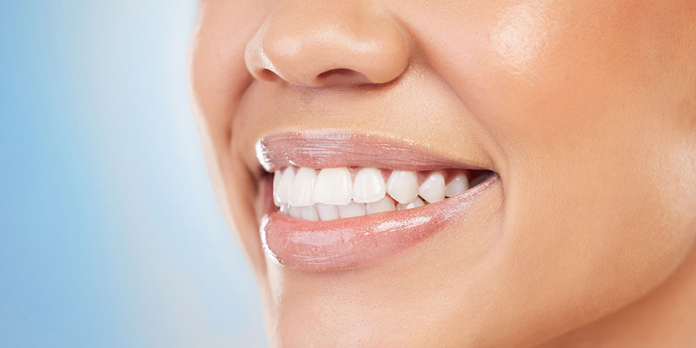 Fluoride Treatment Chestermere