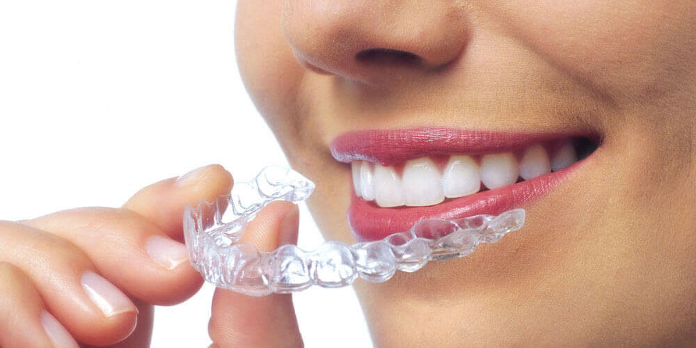 Invisalign Chestermere