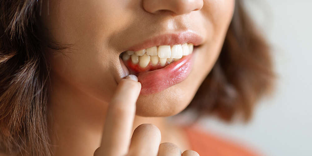 Periodontal Therapy Chestermere